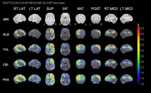 Full Sample PET Scan